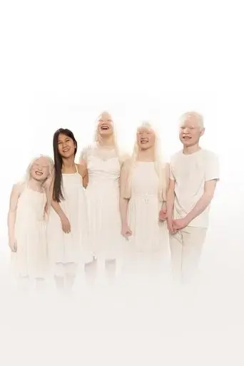 born-with-albinism-2021